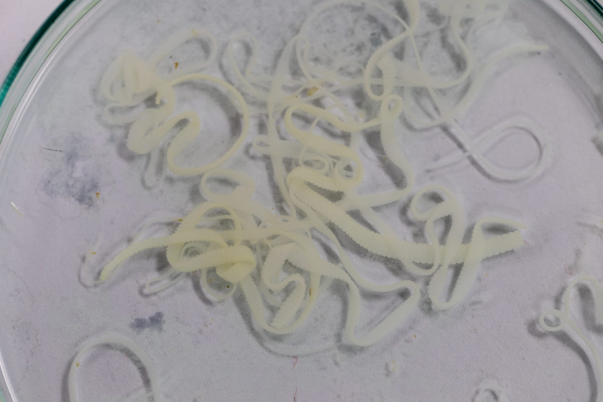 This image has an empty alt attribute; its file name is Pork-tapeworm-656x437.jpeg