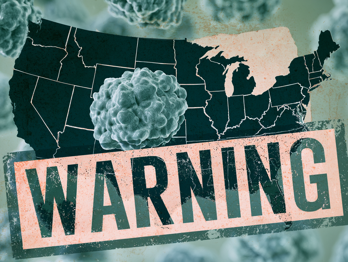 foodsafetynews.com - Bill Marler - Publisher's Platform: Two Countries Are Now Warning Their Citizens About Travel to the United States. Britain Traced Forty-Eight of Its Cases to Mexico. The Cyclospora Count Is Still 22,683.