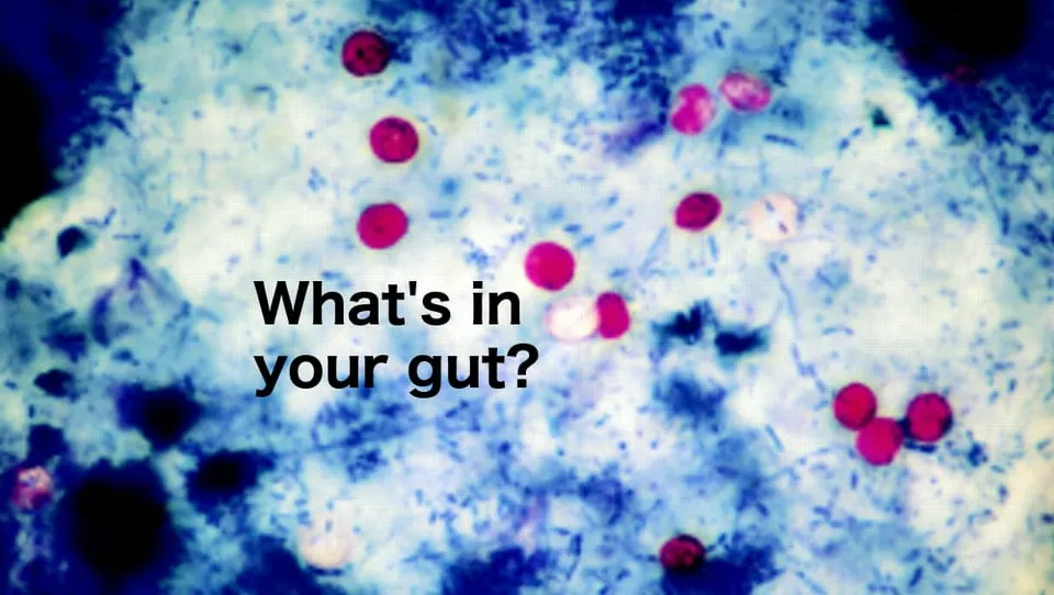Cyclospora cases surge to nearly 600 in Michigan