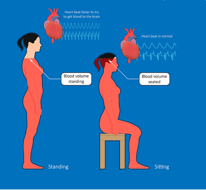 Study Estimates How Common Orthostatic Intolerance, POTS, and Low Blood Pressure Are in Long COVID