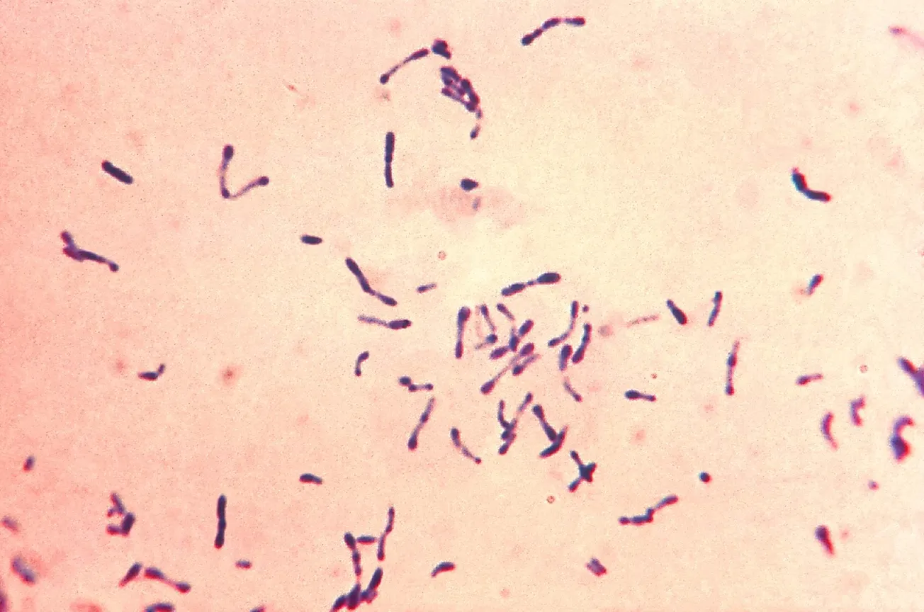 Australia is battling its worst diphtheria outbreak in decades. But vaccines could curb it
