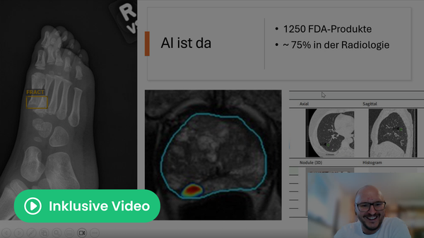 KI in der Medizin: Warum Algorithmen allein das Gesundheitswesen nicht retten