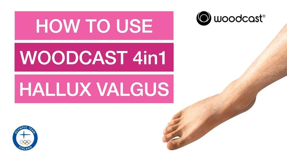 Hallux Valgus