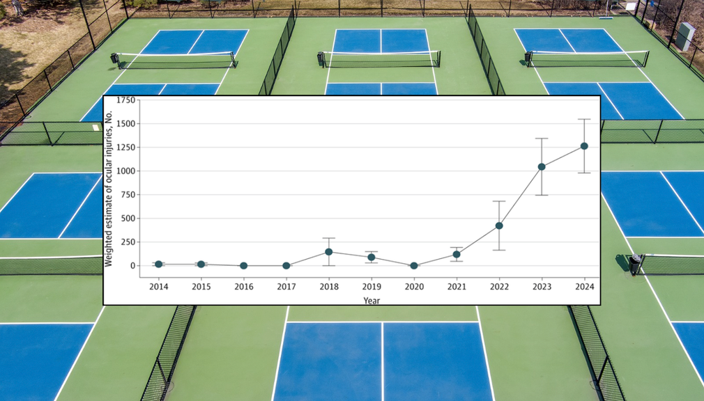                                         Pickleball Eye Injuries Are Growing at an 'Alarming Rate' — With a Few Caveats – News and Stories
                                    