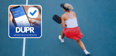 Say Goodbye to Sandbagging?