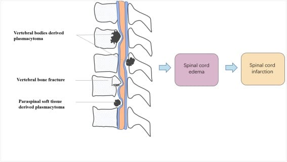 upload in progress, 0