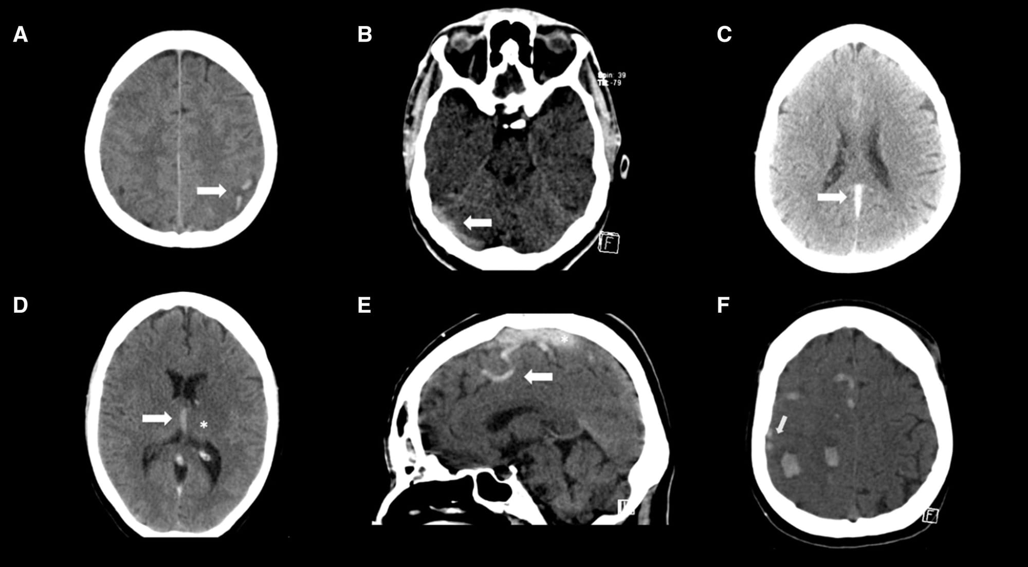 upload in progress, 0