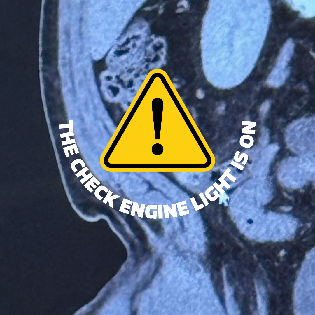 The Check Engine Light is On