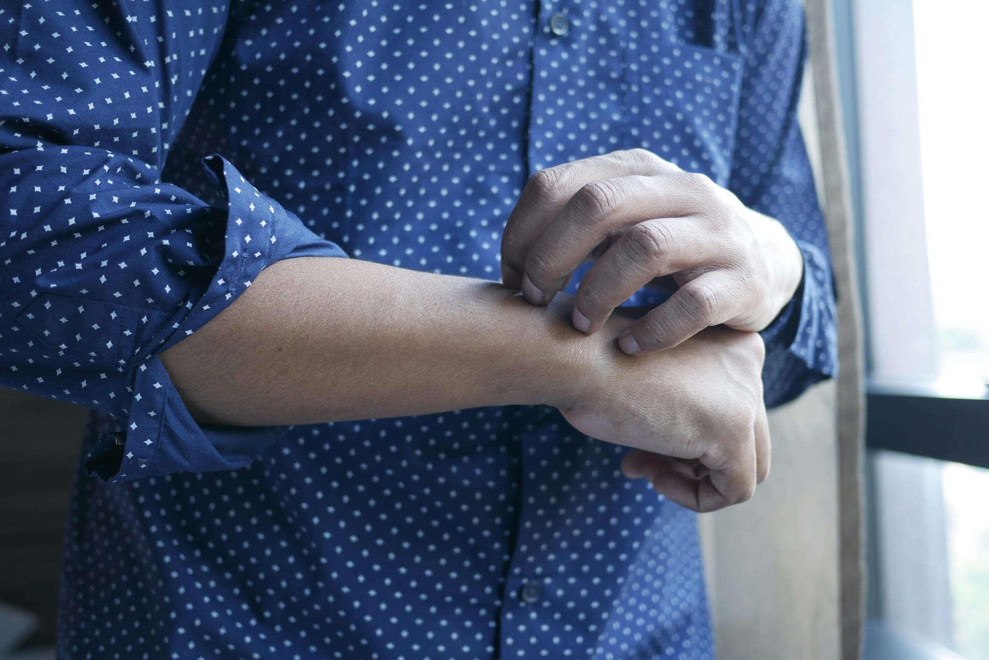 Can humans get fleas? itching and scratching