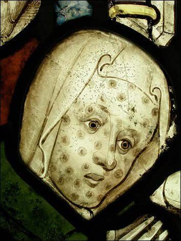 #38 Pochovaní zaživa. Prečo nás už netrápi najdesivejšia choroba stredoveku?