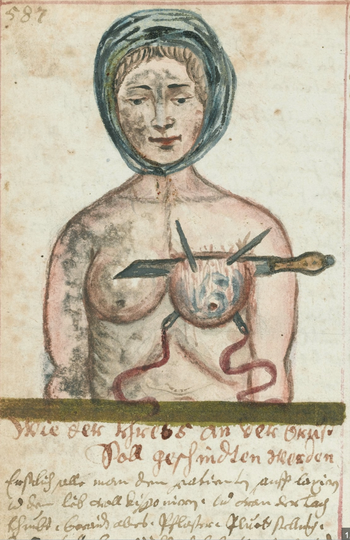 #46 Keď sa rakovina liečila krabom