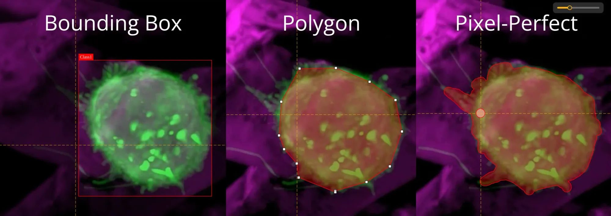 Cancer Tumor Segmentation with Different Image Annotation Types