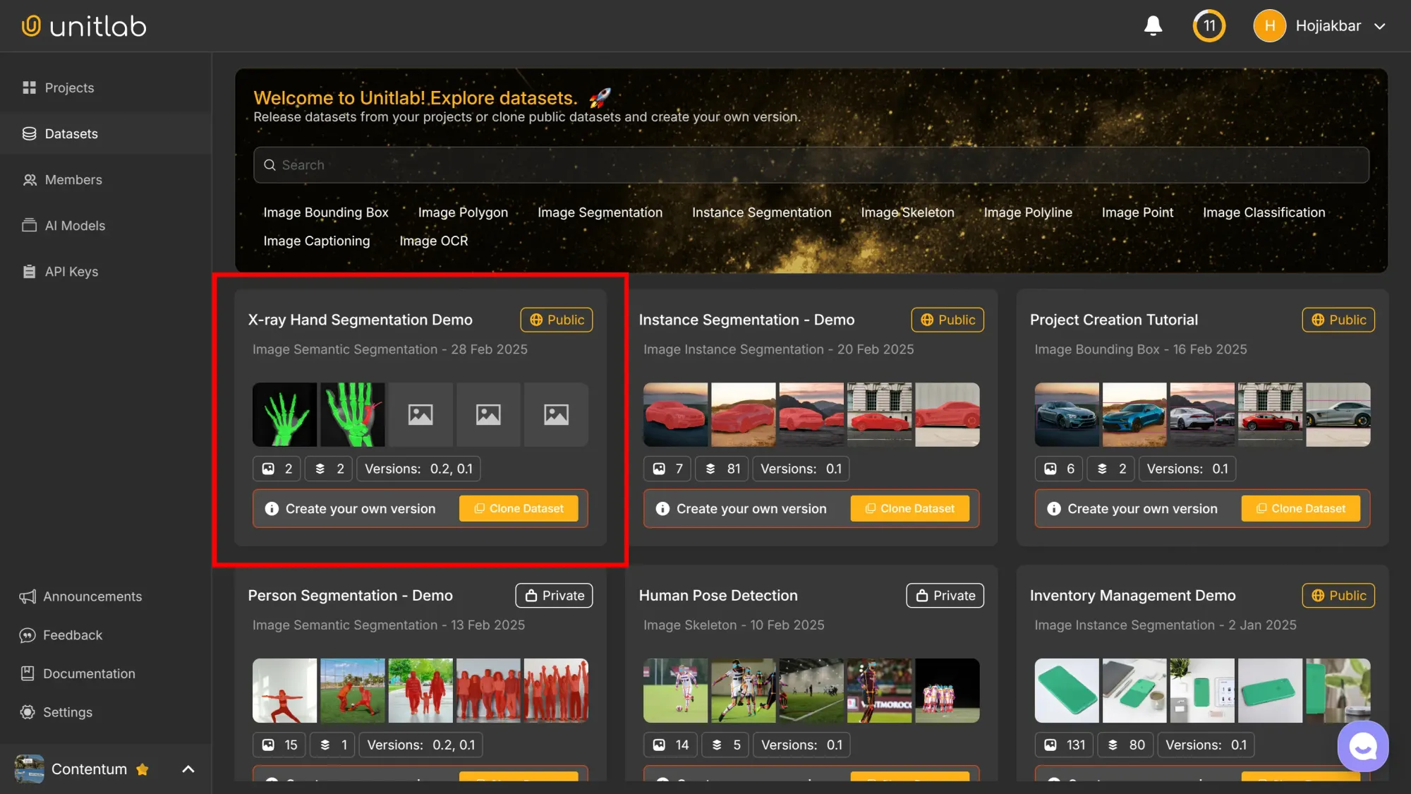 Dataset Page | Unitlab Annotate