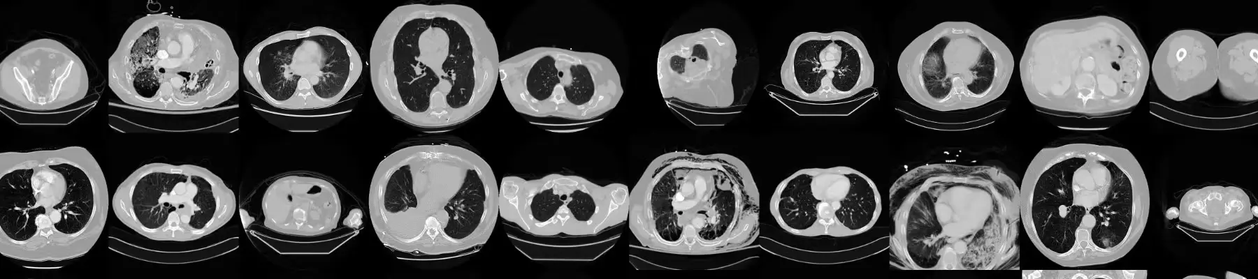CT Medical Images