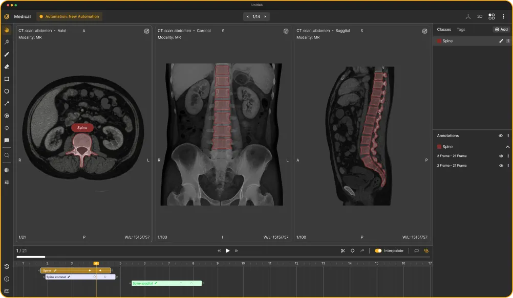 Medical Image Annotation in DICOM: Coming Soon | Unitlab Annotate