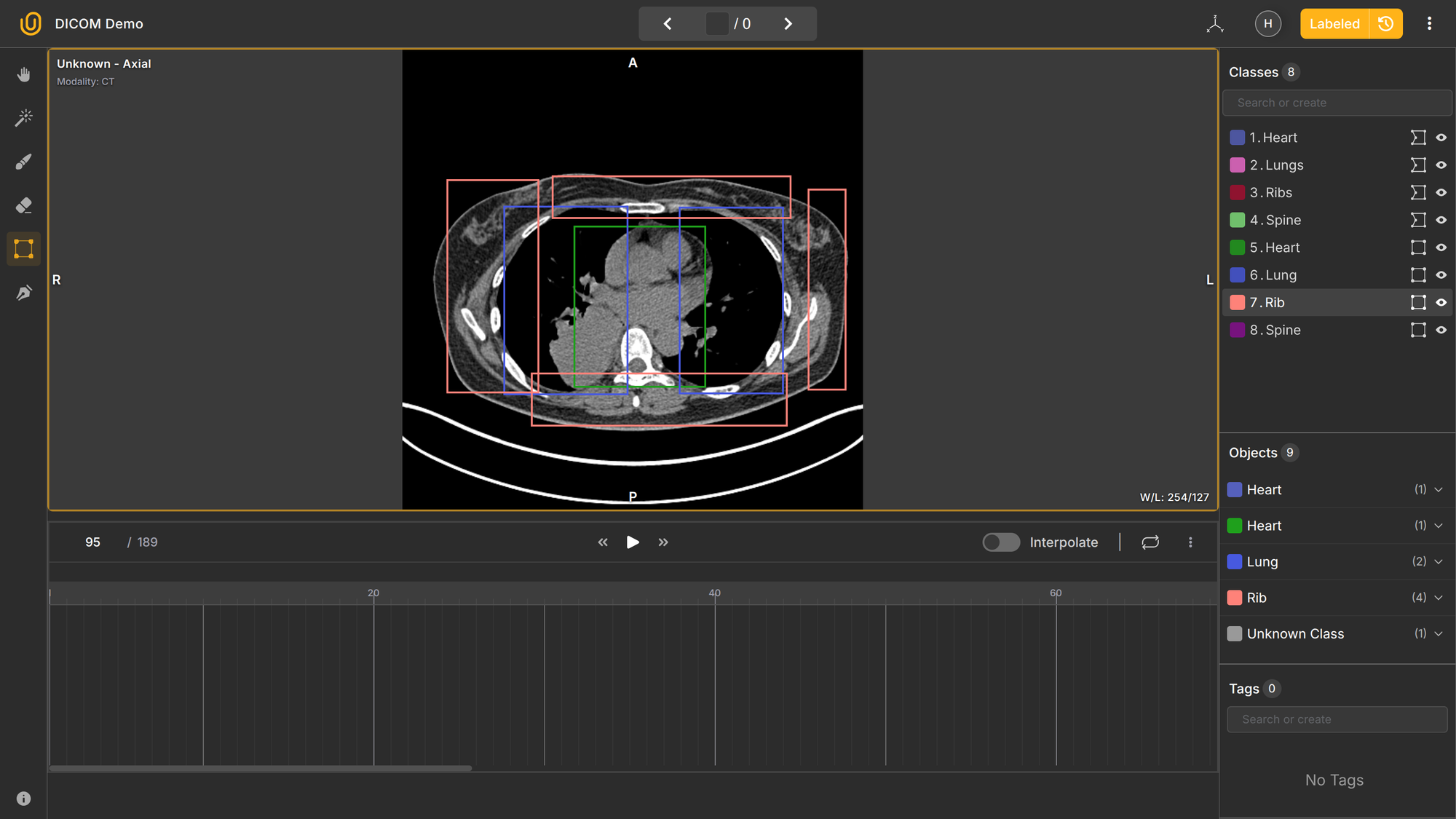 Example of CT slice annotation showing lungs and heart segmentation in Unitlab Annotate