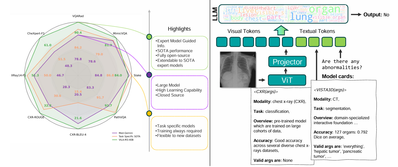 Figure 4: VILA-M3 architecture overview.&nbsp;