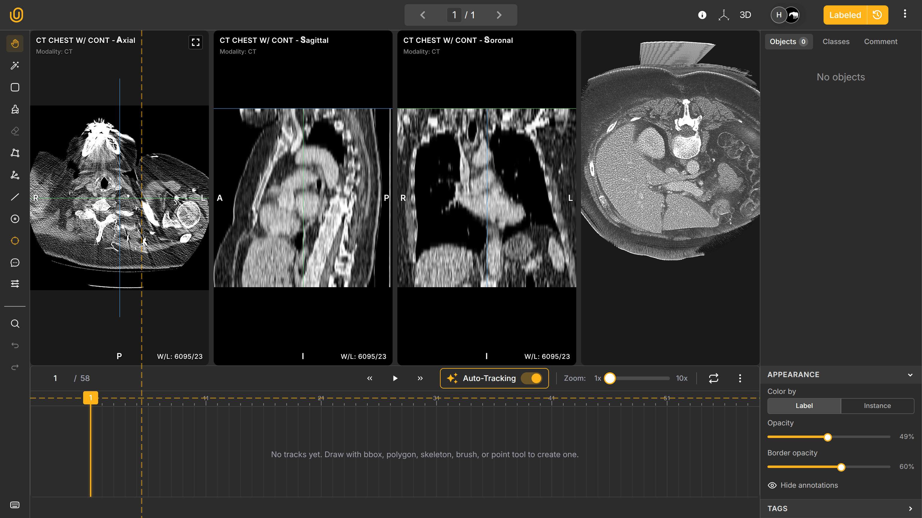 Initial Medical Annotation Work Station | Unitlab AI