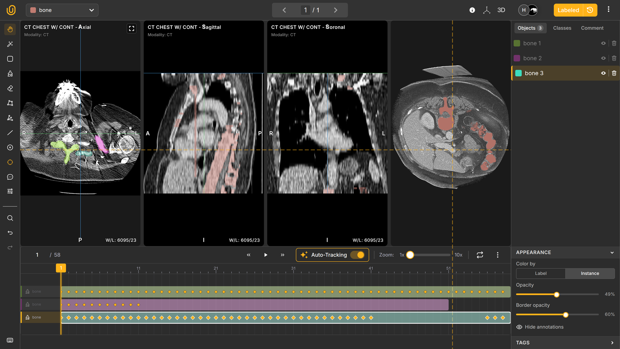 MPR View | Unitlab AI