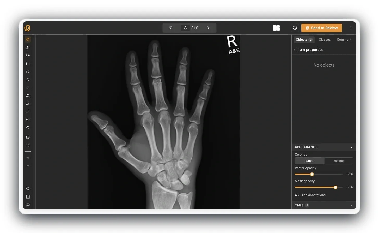 Unitlab AI medical annotation workbench with study navigation and review controls