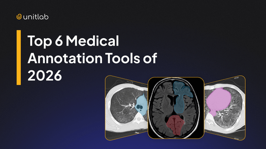 Featured illustration for “6 Best Medical Image Annotation Tools of 2026”