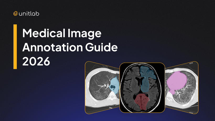 Featured illustration for “The Guide to Medical Image Annotation: Essentials, Techniques, Tools [2026]”