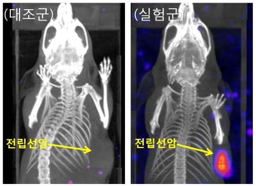 전립선 암세포 추적·치료용 기술, 신약개발로 이어진다