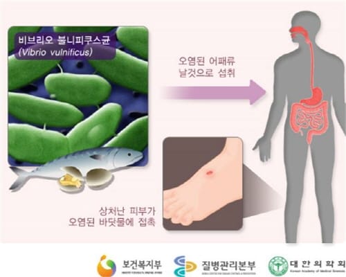 바닷물 온도 상승 “비브리오균 주의”