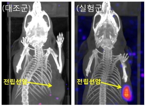 전립선 암세포 추적·치료용 기술, 신약개발로 이어진다 post image