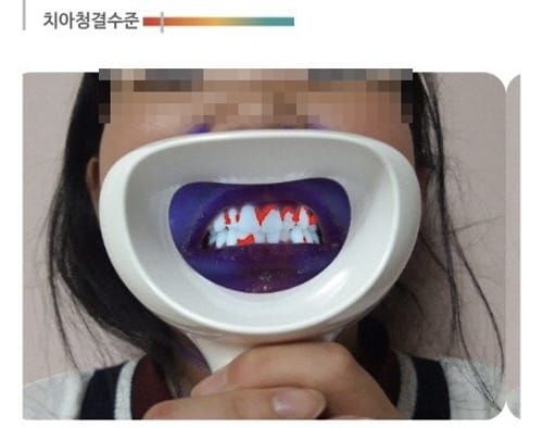 “비대면 가정 구강보건 서비스 신청하세요” post image