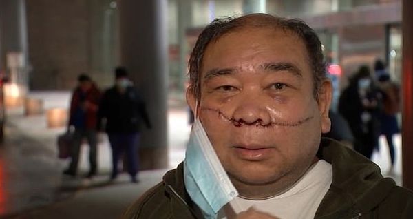 It's Dangerous To Be Asian in America