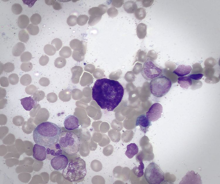Purple-stained cell bodies among grey ones on a white background.
