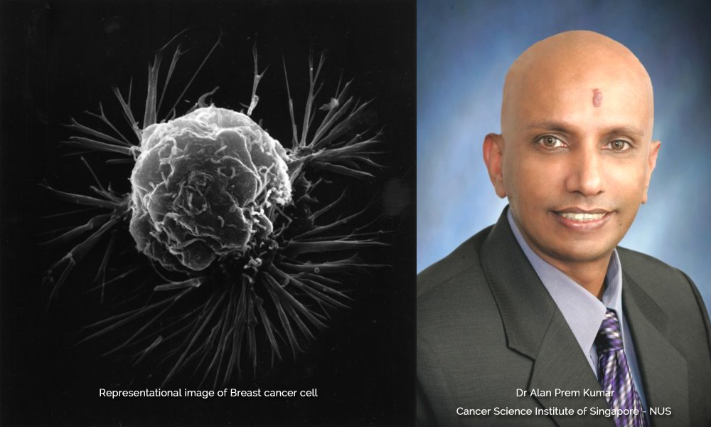 സ്തനാര്‍ബുദ ചികിത്സയ്ക്ക് പ്രത്യാശയായി മലയാളി ശാസ്ത്രഞ്ജന്‍റെ കണ്ടുപിടുത്തം