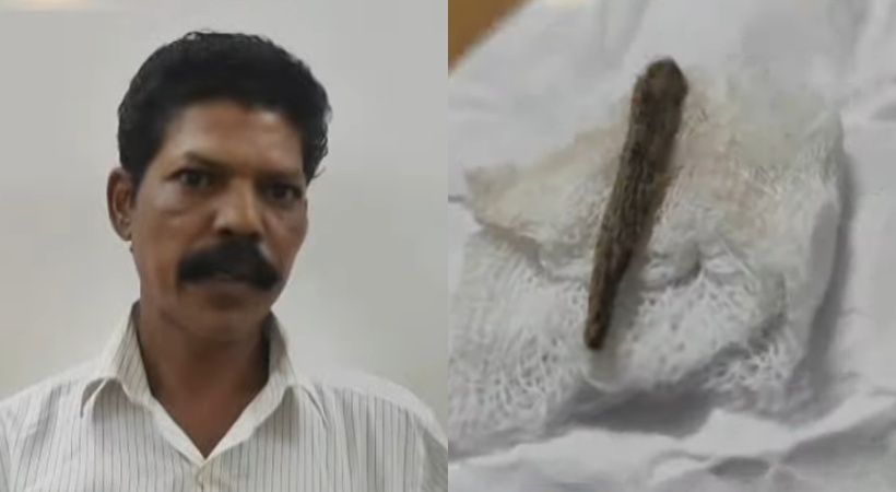 ചേലക്കര താലൂക്ക് ആശുപത്രിയില്‍ ചികിത്സാപ്പിഴവ്; തുന്നിക്കെട്ടിയ മുറിവില്‍ നിന്ന് 5 മാസത്തിന് ശേഷം മരച്ചീള് കണ്ടെത്തി