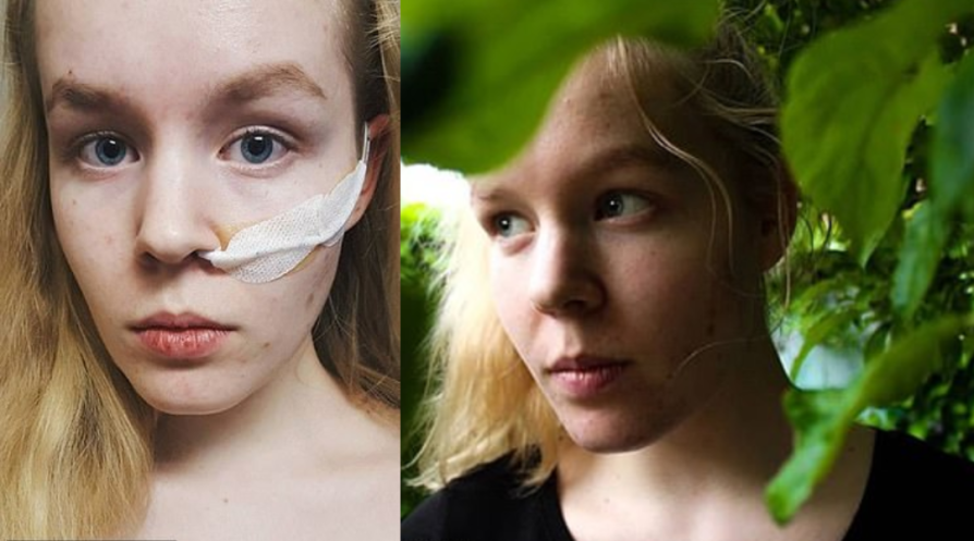 ലൈംഗിക ചൂഷണത്തിന് ഇരയായ പതിനേഴുകാരി ദയാവധം സ്വീകരിച്ചു