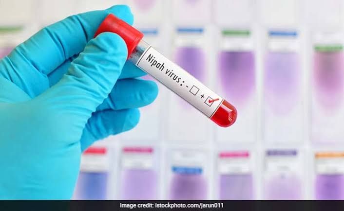 കോഴിക്കോട് നിപ തന്നെ: പൂനെ വയോജന ഇൻസ്ററിടൂട്ടിൽ നിന്നും ഫലം സ്ഥിരീകരിച്ചു