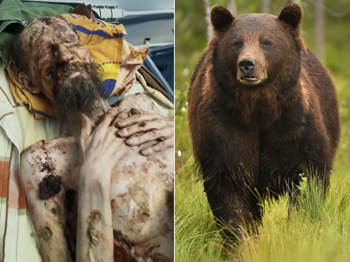 നട്ടെല്ല് തകർത്തിട്ട്  കരടി തടവിലാക്കിയത് ഒരുമാസത്തോളം; എല്ലും തോലുമായ മനുഷ്യൻ രക്ഷപ്പെട്ടു: വീഡിയോ  വൈറൽ