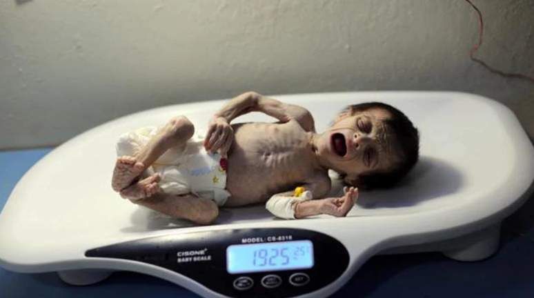 മാപ്പ്; ജനിച്ച് ഒരു മാസം തികയുന്നതിന് മുന്‍പ് വിശന്ന് മരിക്കാനായിരുന്നു അവളുടെ വിധി