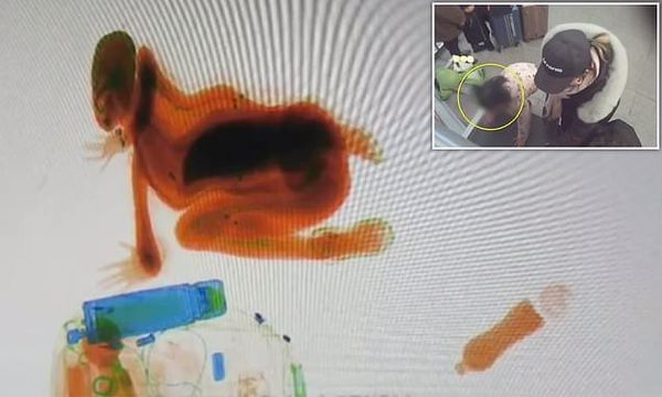 മാതാപിതാക്കളുടെ  കണ്ണുവെട്ടിച്ച് സ്‌കാനറിൽ  കയറി  അഞ്ചുവയസ്സുകാരിയുടെ കുസൃതി; വീഡിയോ  വൈറൽ  ആകുന്നു