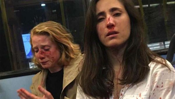 ഉമ്മ വെക്കാന്‍ ആവശ്യപ്പെട്ടു;  നിരസിച്ച  സ്വവര്‍ഗ സ്ത്രീ പങ്കാളികളെ   ബസ് യാത്രക്കാര്‍ക്കിടെ വെച്ച് സംഘം ചേര്‍ന്ന് മര്‍ദിച്ചു