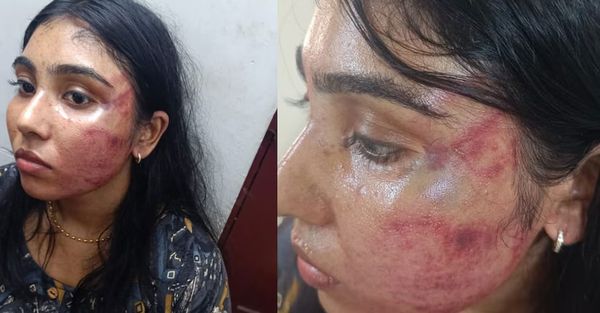 ‘നീ ആരോടാണ് സംസാരിക്കുന്നതെന്നു ചോദിച്ച് മുഖത്ത് അടിച്ചു’: ജൂനിയര്‍ അഭിഭാഷകയെ തല്ലിയ ബെയ്‌ലിന് സസ്പെൻഷൻ