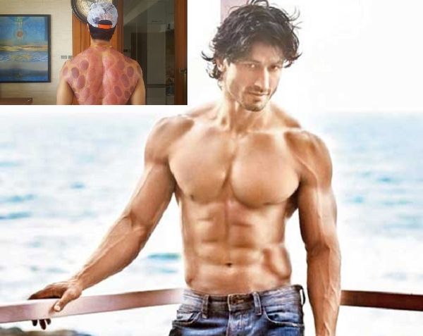 Cupping therapy introduced in India by Vidyut Jammwal