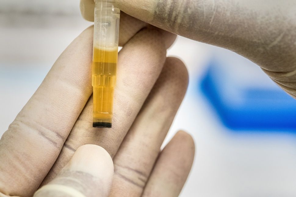 Csak indokolt esetben végeznének drogtesztet a diákon