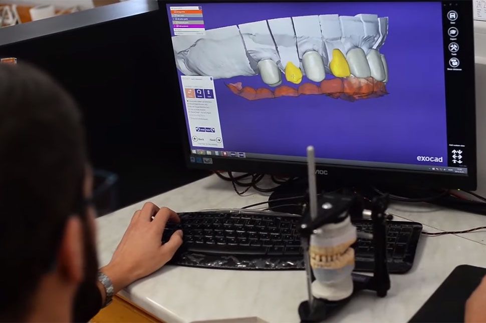 Bővült a Simo's Dental