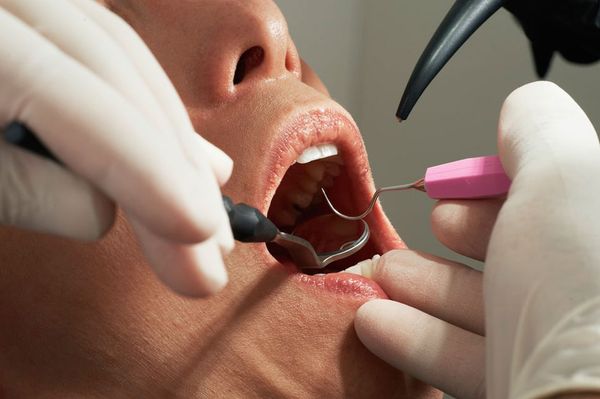 Fogorvosi ügyelet a hétvégén