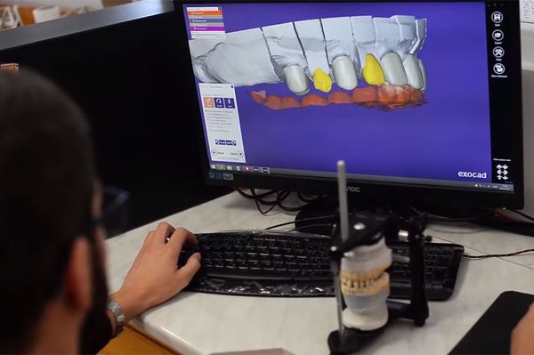 Bővült a Simo's Dental