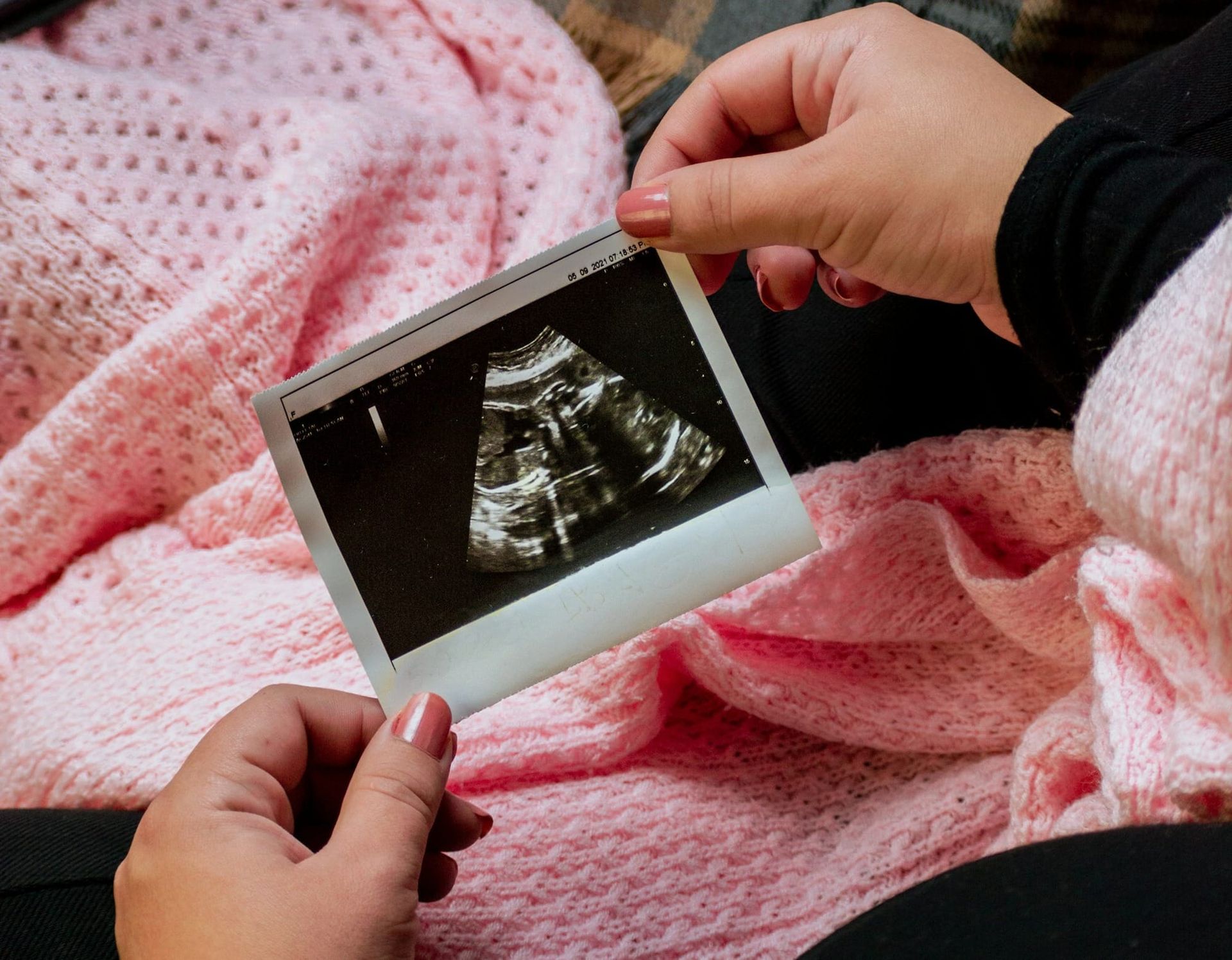Derechos sexuales y reproductivos en la segunda vuelta: memoria, autonomía y los cuerpos de las mujeres