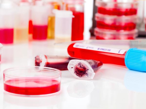 Blutwerte verstehen in 30 Sekunden – Wie BloodGPT das Arztgespräch neu erfindet