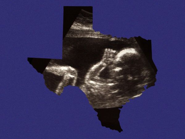 So You Want To Get Pregnant in Texas? How To Navigate Abortion Bans and Rising Maternal Mortality Rates