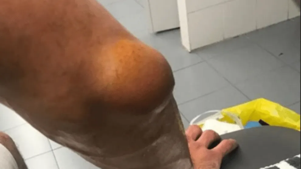 La photo: le coude de Sergio Llull après un match d’Euroleague